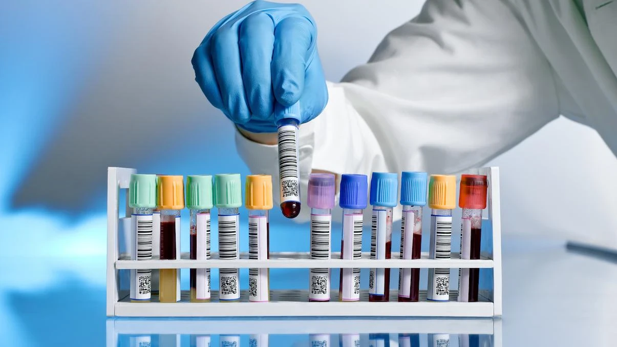 image about هل معامل الروماتويد يدل على وجود روماتويد مفصلي ؟