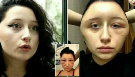 image about أضرار ومخاطر صبغات الشعر ومدى ارتباطها بالسرطان