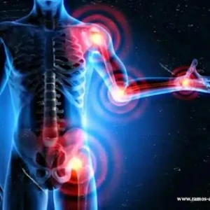 image about مشاكل المفاصل وطرق الوقاية منها