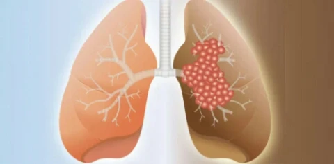 image about مخاطر تهدد الجهاز التنفسي