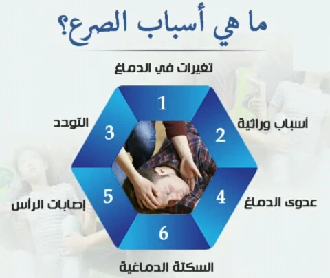 image about عندما تخرج الإشارات الكهربائية للدماغ عن السيطرة.