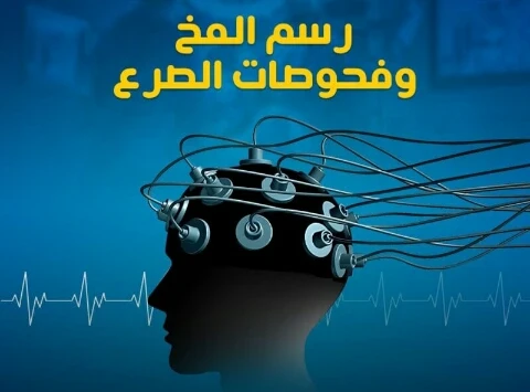 image about عندما تخرج الإشارات الكهربائية للدماغ عن السيطرة.