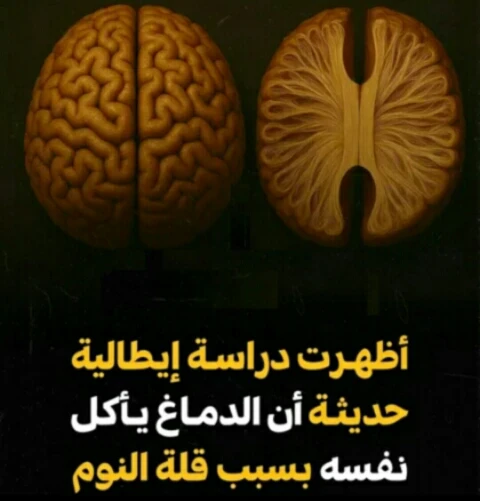 image about عندما يصبح الدماغ غير قادر على إصلاح نفسه.