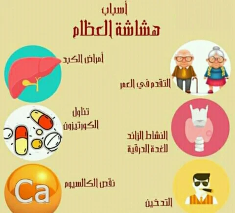 image about المرض الصامت الذي يهدد قوة الهيكل العظمي.