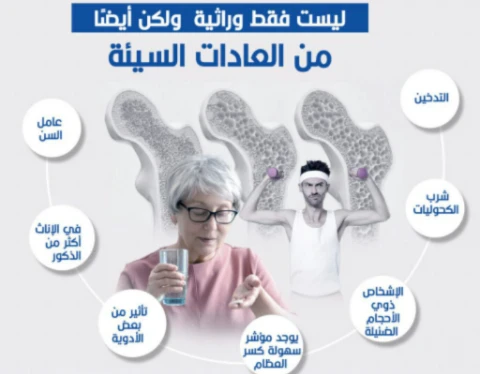 image about المرض الصامت الذي يهدد قوة الهيكل العظمي.