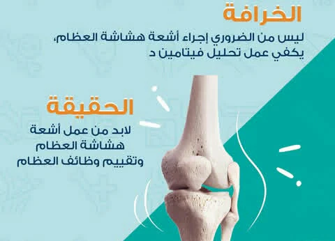 image about المرض الصامت الذي يهدد قوة الهيكل العظمي.