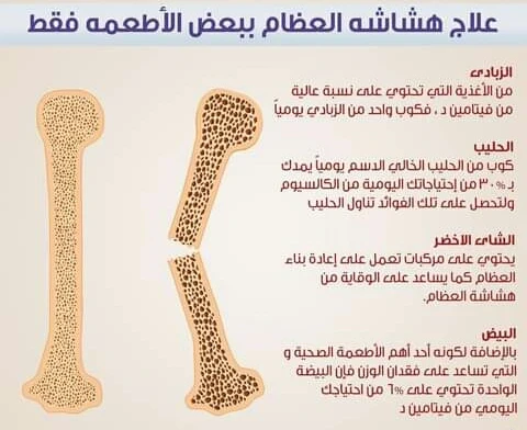 image about المرض الصامت الذي يهدد قوة الهيكل العظمي.