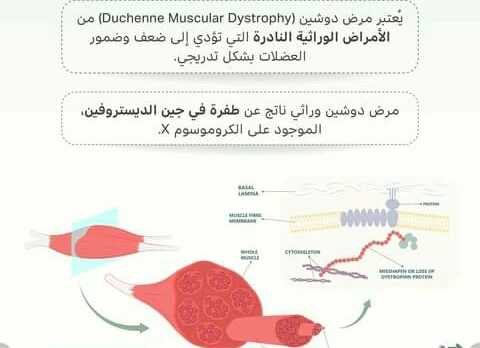 image about التحدي الجيني الذي يواجهه العضلات