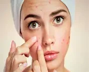 image about أسباب تجاعيد الوجه وكيف تحافظين على بشرتك شابة دائمًا