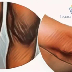 image about كيف تتخلصين من اسمرار الكوعين و الركب