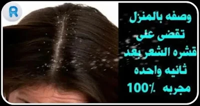 image about خل التفاح ضد القشرة، لذا افعلوا ذلك