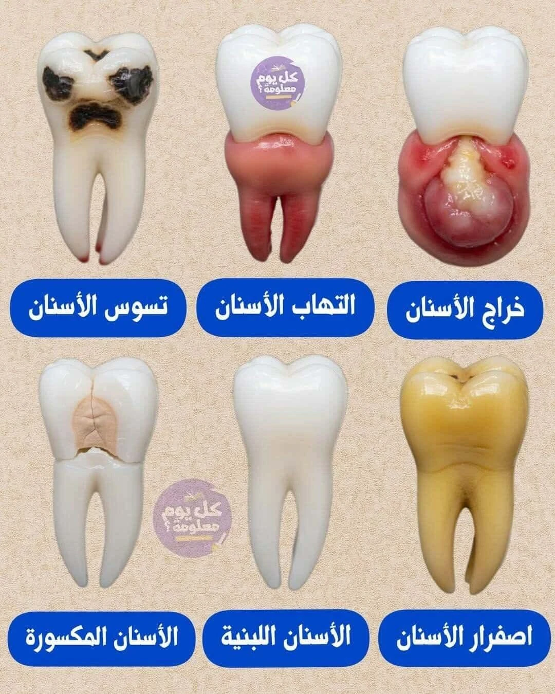 image about مخاطر أمراض الأسنان وطرق الوقاية منها