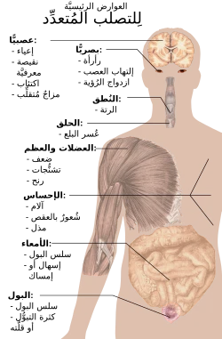 image about حين يهاجم الجهاز المناعي نفسه : رحلة داخل مرض التصلب المتعدد للأعصاب