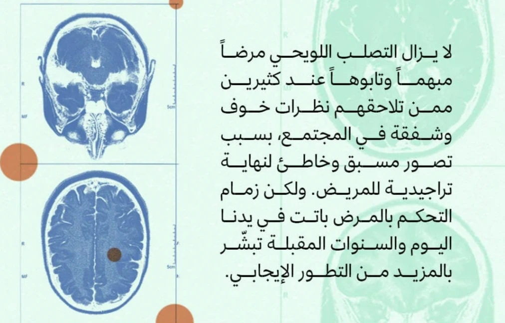 image about حين يهاجم الجهاز المناعي نفسه : رحلة داخل مرض التصلب المتعدد للأعصاب