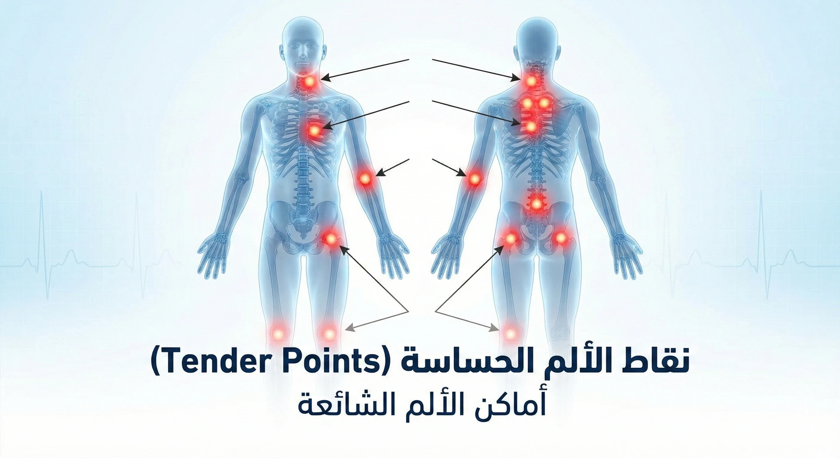 image about الفيبرومياليجيا : حين يصرخ الجسد بصمت ... دليلك الشامل لفهم