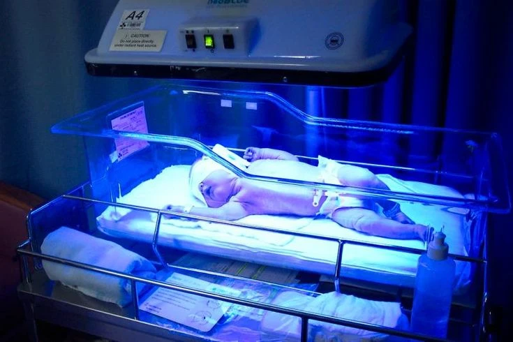 image about الصفراء ( Jaundice): أسبابها وطرق علاجها الصحيحة