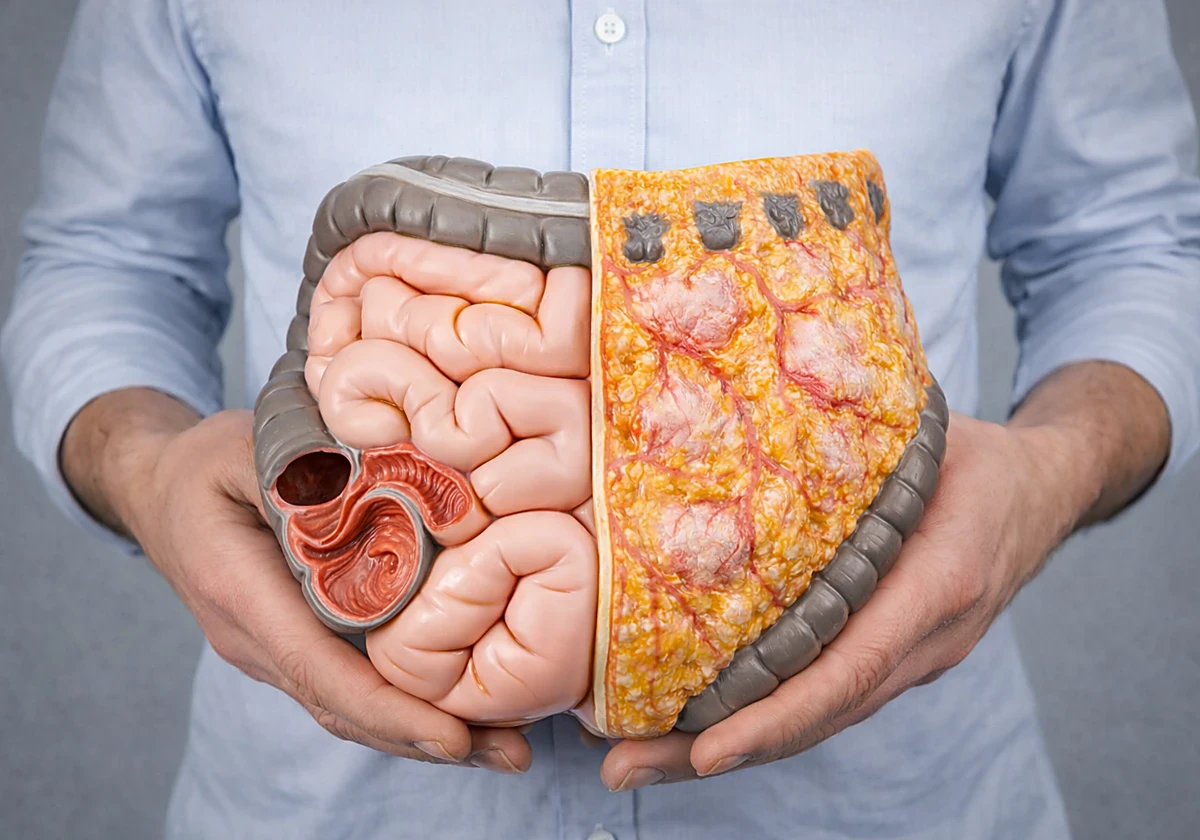 image about القناة الهضمية المتسربة: ما هي ولماذا تحدث وكيف تؤثر علينا