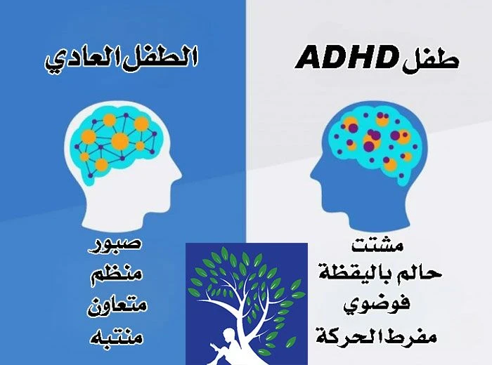 image about اضطراب فرط الحركة وتشتت الانتباه 