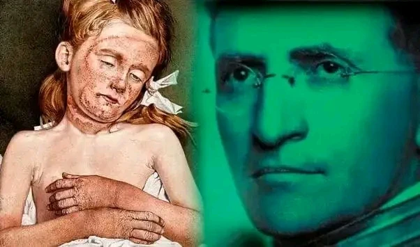 image about اغرب تجربة طبية فى العالم للتخلص من الموت الاحمر