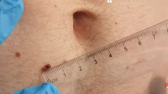 image about علامات مبكرة قد تدل على السرطان – انتبه لها مبكرًا