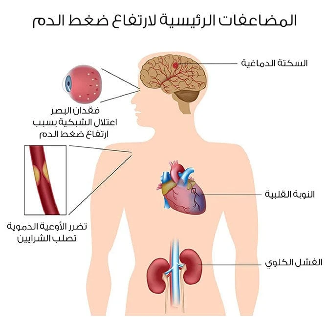 image about ارتفاع ضغط الدم: القاتل الصامت الذي يهدد حياتك دون أن تشعر