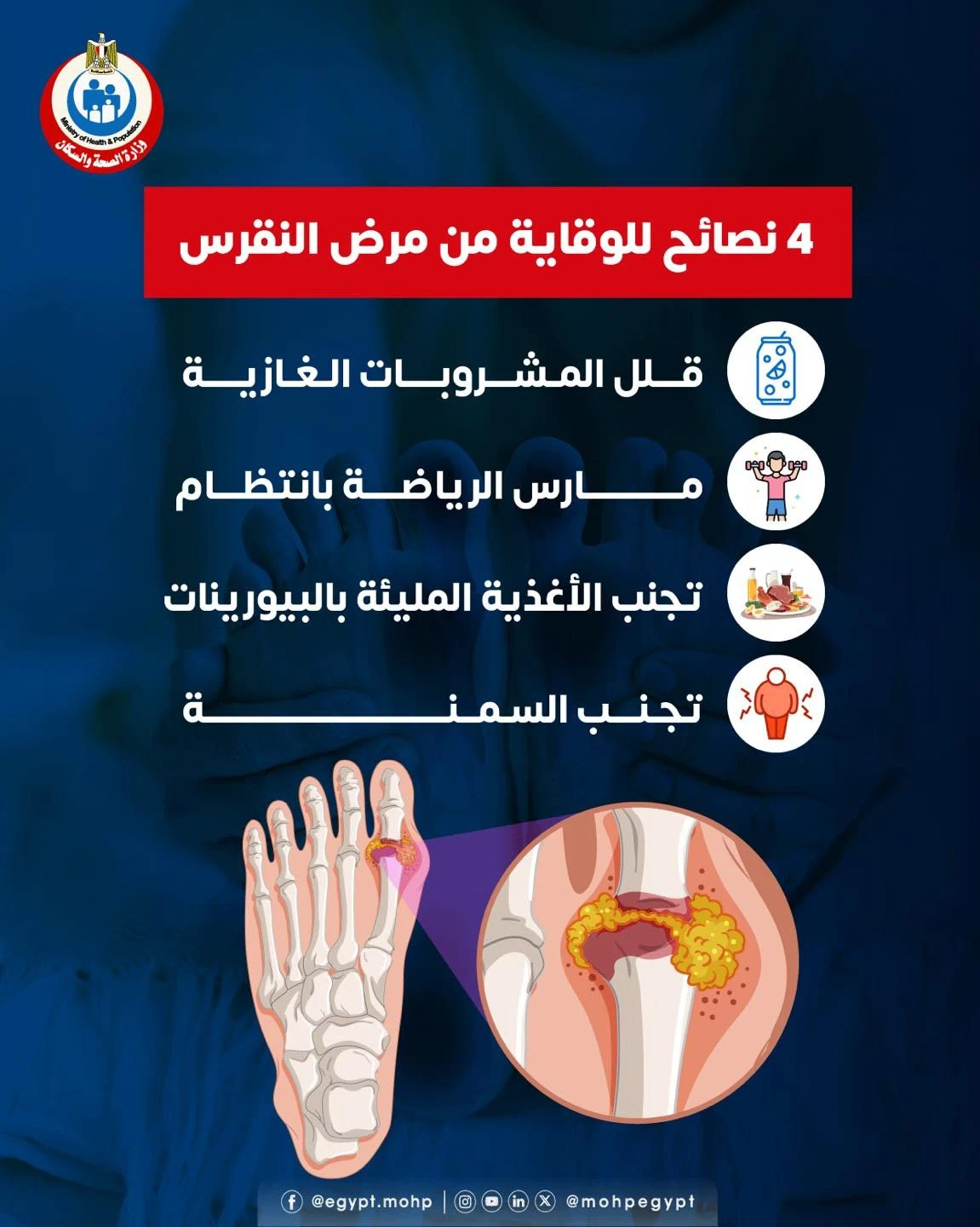 image about النقرس: لماذا يصيبك فجأة؟ وكيف تعالجه قبل أن يتفاقم