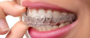 image about تقويم الأسنان : الطريق إلى ابتسامة صحية وثقة أكبر