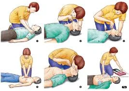 image about لو حد وقع قدامك فجأة… هل تعرف تنقذه؟ | شرح CPR و الفرق بين BLS و ALS