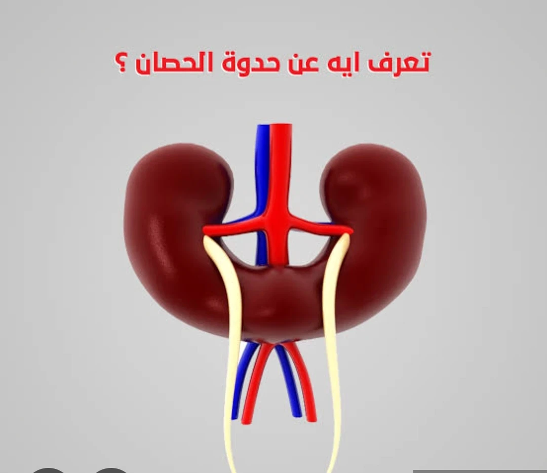 image about الفرق بين الكلى حدوة الحصان و الكلى الطبيعى اسرار طبية ؟؟؟