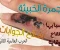 مرض الجمرة الخبيثة 