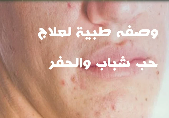 العنايه للبشرة الدهنية والبقع السوداء