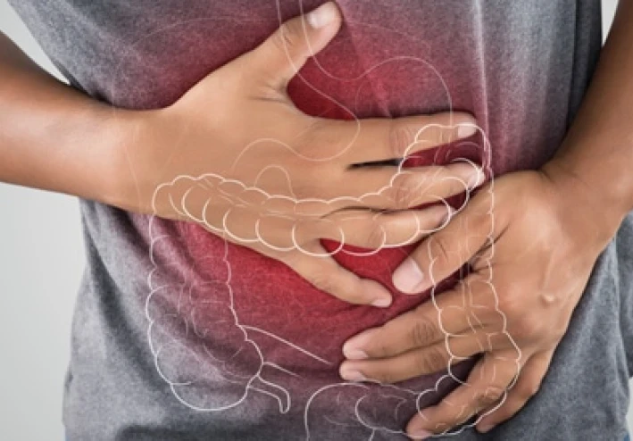 متلازمة القولون العصبي Irritable bowel syndrome