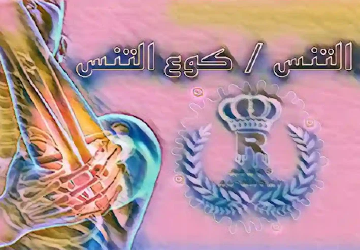 ما هو مرفق التنس أو كوع التنس ؟ - الإصابات الرياضية