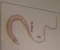 صورة مقال الديدان الطبية_ داء المسلكات_ المسلكة شعرية الرأس  Trichuris Trichiura