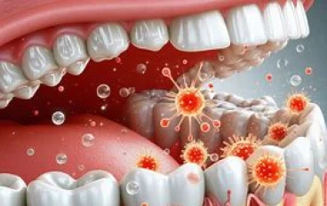 تورم اللثة: الأسباب، العلاج، الأعراض، والمدة الزمنية للشفاء