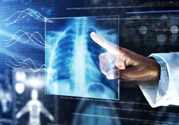 طب الأشعة والتصوير الشعاعي: عين الطب الحديث ومستقبل التشخيص الرقمي