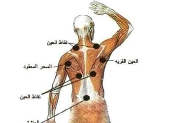 الحسد والعين والسحر والتخلص منه