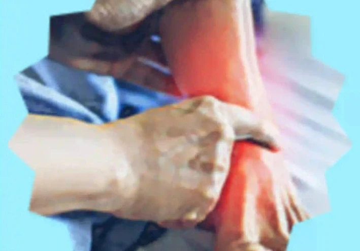 الإصابات الرياضية كسور الإجهاد - كل ما تحتاج إلى معرفته