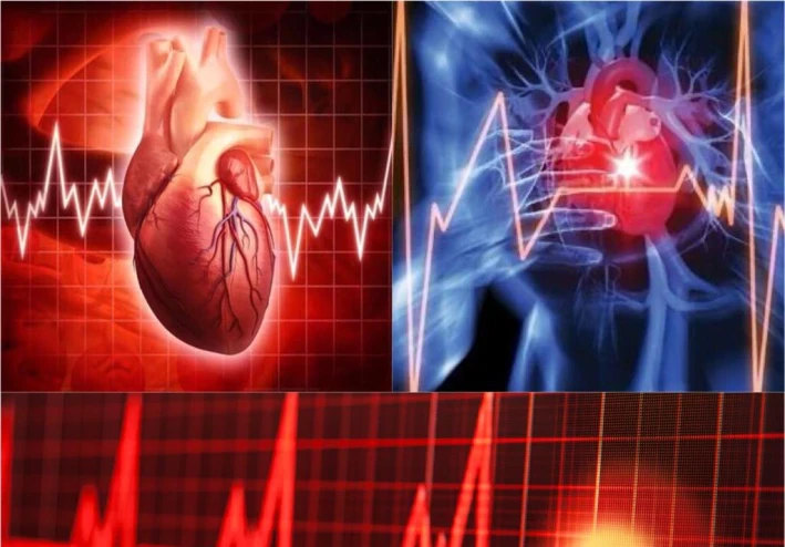 مرض اضطراب نبضات القلب : اسباب اضطراب نبضات القلب و طرق العلاج