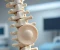 صورة مقال Understanding Herniated Disc: Symptoms, Treatment, and Prevention Guide