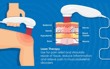 Laser Therapy: The Revolutionary Solution for Chronic Pain Relief with Amazing Effectiveness!