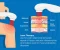 article image for Laser Therapy: The Revolutionary Solution for Chronic Pain Relief with Amazing Effectiveness!