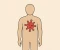 article image for اعراض مرض السرطان 