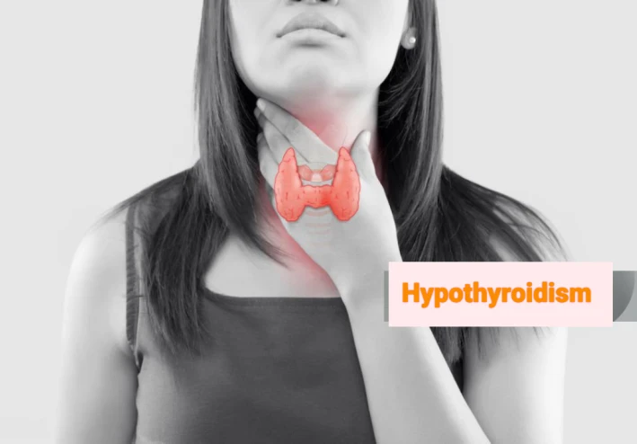 Hypothyroidism (underactive thyroid): symptoms and causes