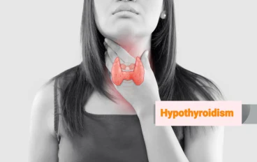 Hypothyroidism (underactive thyroid): symptoms and causes