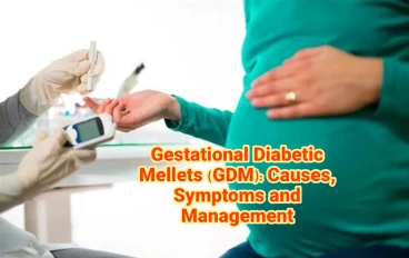 Gestational Diabetic Mellets (GDM): Causes, Symptoms and Management 