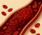 article image for تكثيف الدم: أسبابه وأعراضه وخطورته على الصحة العامة
