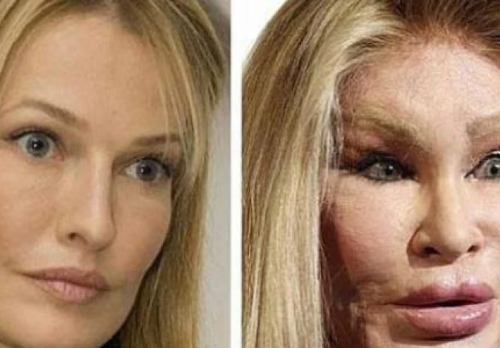 مخاطر عمليات التجميل