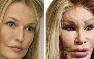 مخاطر عمليات التجميل 
