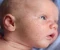 صورة مقال علاج حبوب الصيف عند الاطفال بكل بساطه 👶
